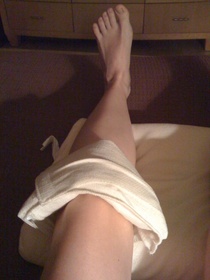 icing-the-knee-by-Jill-Glossy-Veneer.jpg