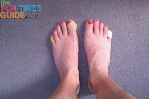 feet-blisters